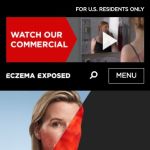 Market Development Website Eczema Exposed - Mobile Homepage