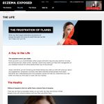 Market Development Website Eczema Exposed - The Life