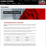 Market Development Website Eczema Exposed - The Science