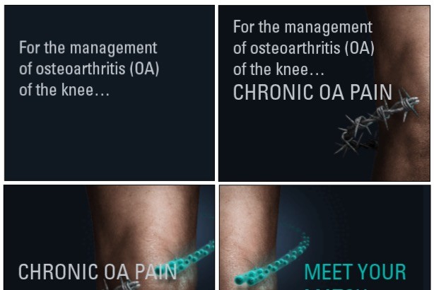 OA of the Knee Pharma Banner Ad Examples